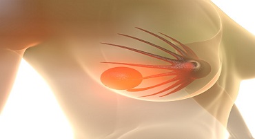 Фиброаденома