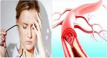 Дослідження судин шиї та головного мозку