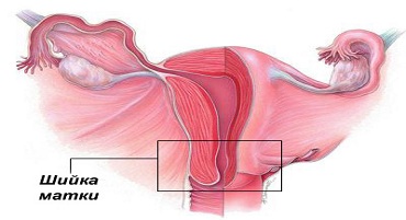 Шийка матки на УЗД
