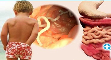 Ложные утверждения о гельминтов