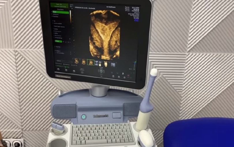 Нове УЗ обладнання з вагінальним датчиком 4D