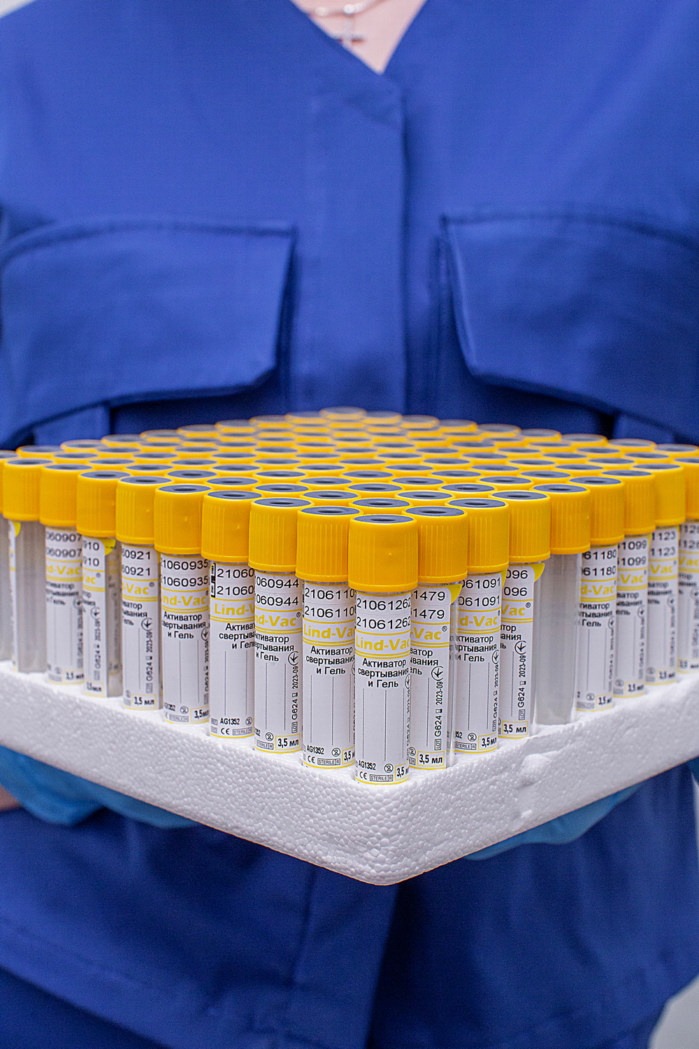 Продовжили години забору матеріалу для лабораторної діагностики