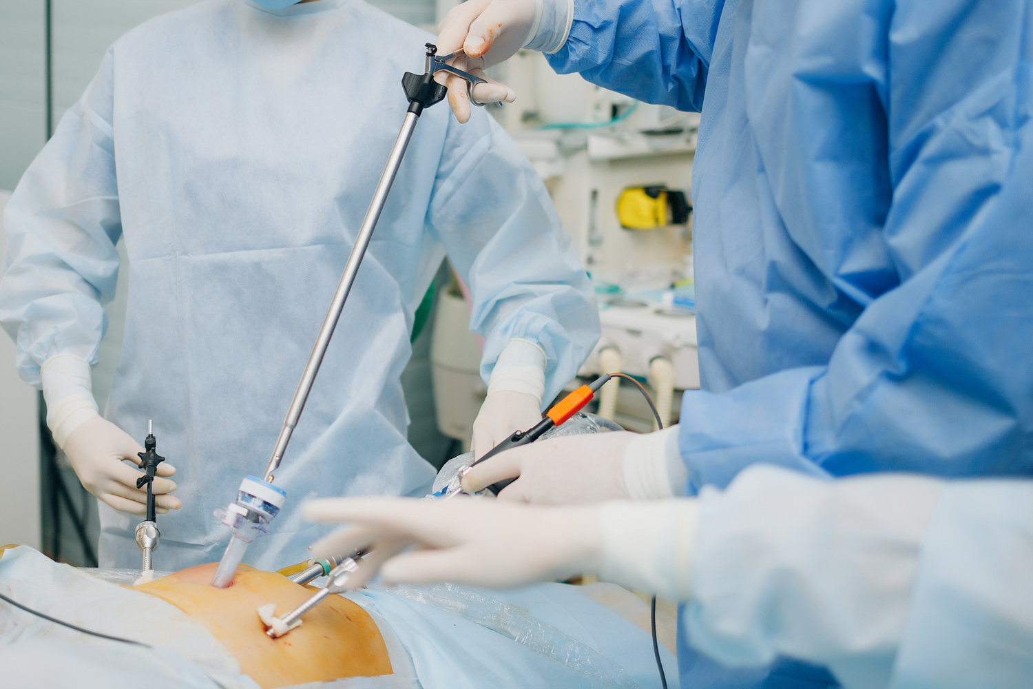 Видеоэндоскопическое хирургическое лечение гинекологических патологий 3D в качестве 4К