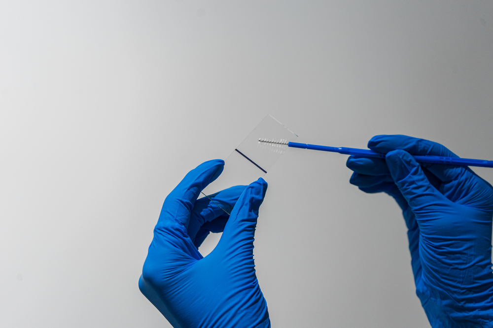 огляд у гінеколога